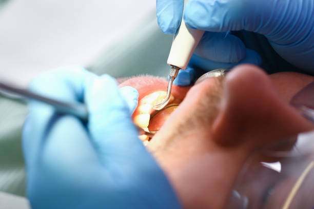 Best Emergency Tooth Extraction in Harmony, PA