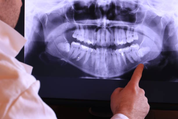 Best Urgent Care for Lost Fillings or Crowns in Harmony, PA
