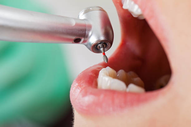 Best Emergency Treatment for Dental Infections or Abscesses in Harmony, PA